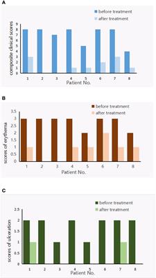 Baricitinib is potentially effective in the treatment of refractory livedoid vasculopathy